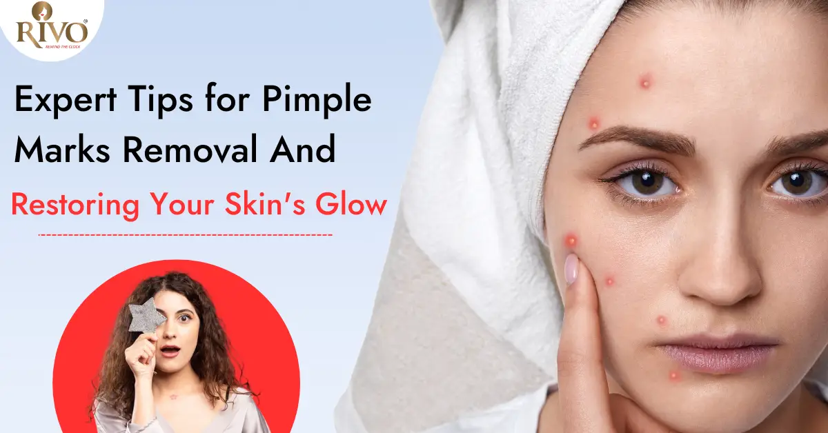 Expert Tips for Pimple Marks Removal and Restoring Your Skin's Glow