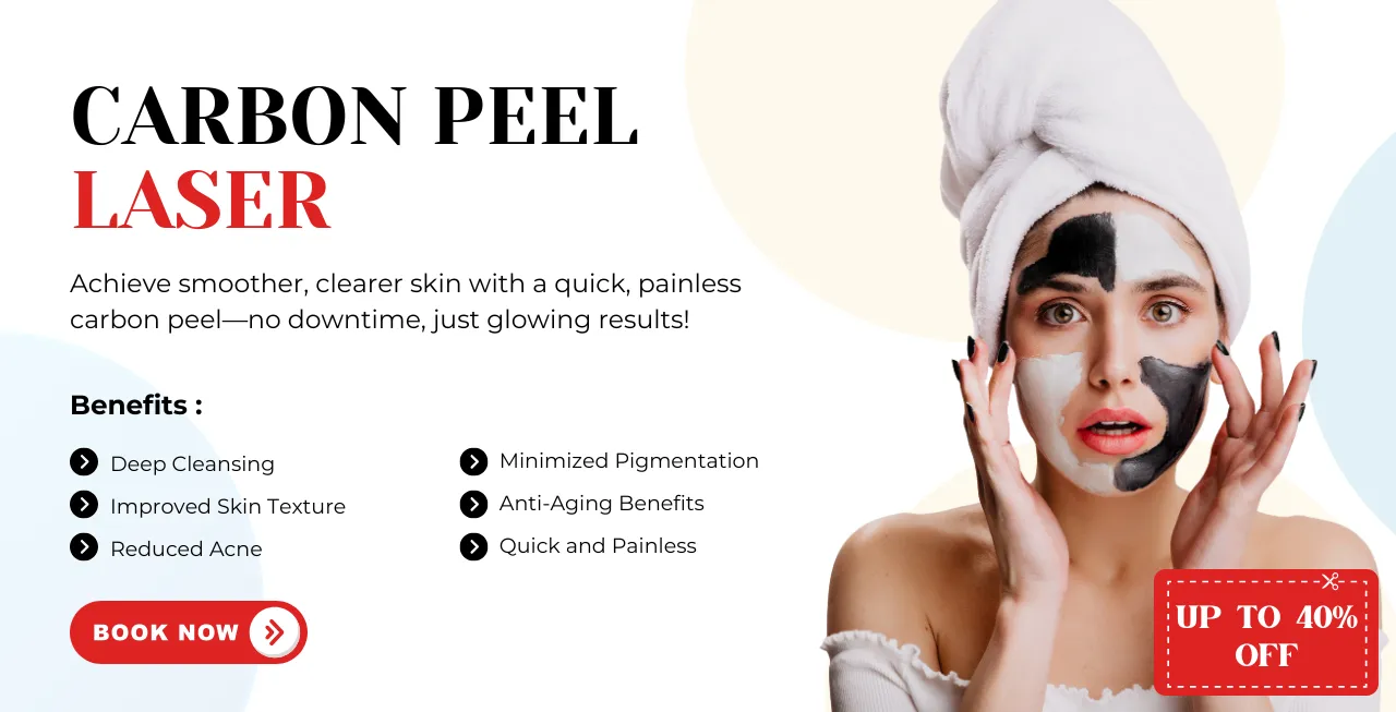 Carbon peel Laser