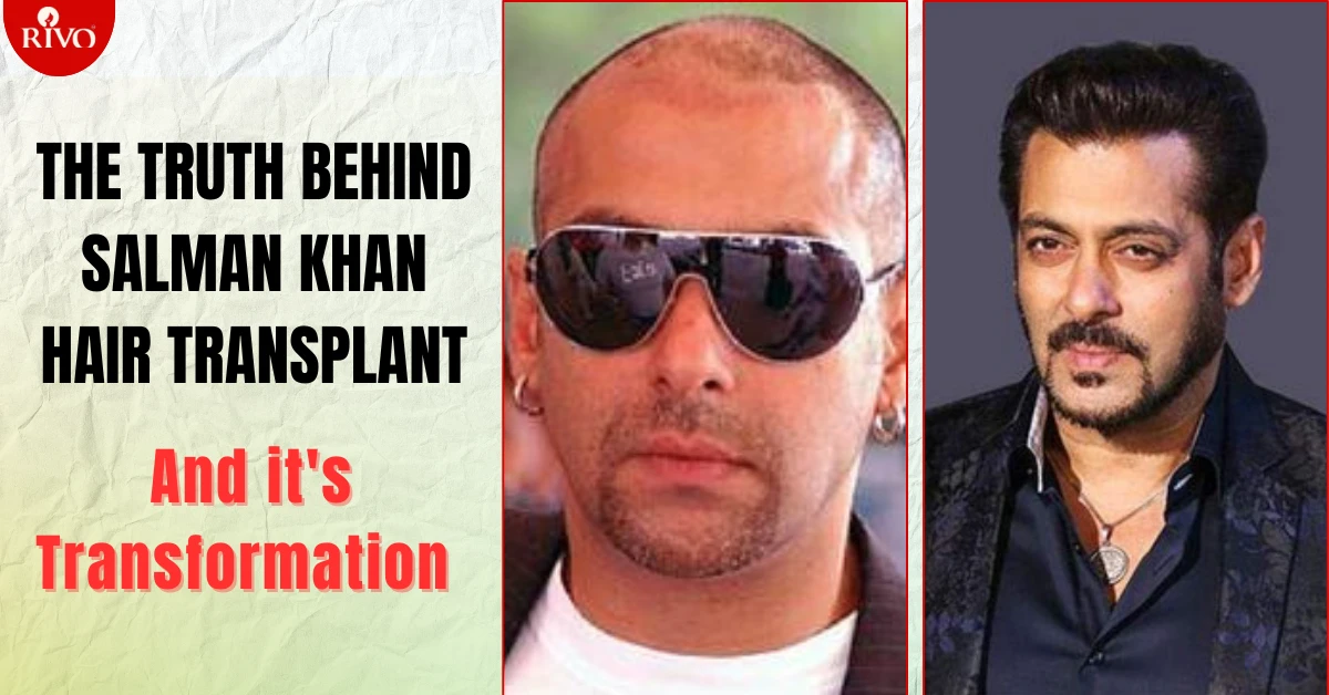 The Truth Behind Salman Khan's Hair Transplant and Its Transformation