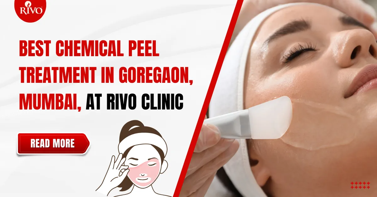 Best Chemical Peel Treatment in Goregaon Mumbai at Rivo Clinic